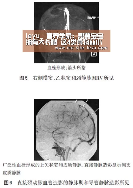 乐鱼